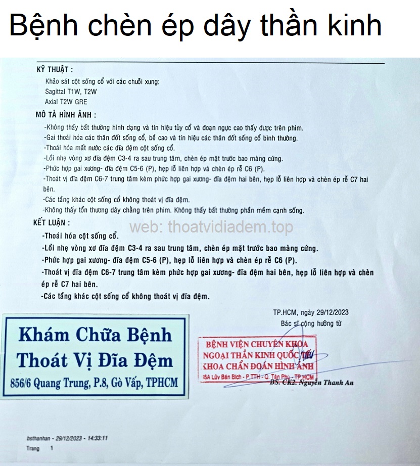 Bệnh chèn ép dây thần kinh